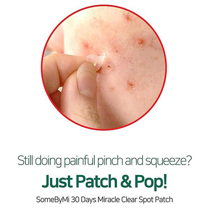 30 Days Miracle Acne Clear Spot Patch